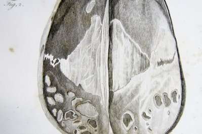 Museum of Anatomy and Pathology in Nijmegen, Netherlands – Museum Information gallery image